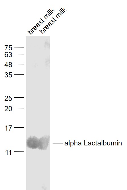 Lane 1: Breast milk lysates; Lane 2: Breast milk lysates probed with alpha Lactalbumin Antibody, Unconjugated (bs-11131R) at 1:1000 dilution and 4˚C overnight incubation. Followed by conjugated secondary antibody incubation at 1:20000 for 60 min at 37˚C.
