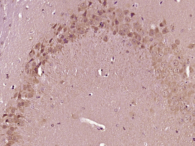 Paraformaldehyde-fixed, paraffin embedded Mouse brain; Antigen retrieval by boiling in sodium citrate buffer (pH6.0) for 15min; Block endogenous peroxidase by 3% hydrogen peroxide for 20 minutes; Blocking buffer (normal goat serum) at 37°C for 30min; Antibody incubation with FAM38A Polyclonal Antibody, Unconjugated (bs-14991R) at 1:400 overnight at 4°C, DAB staining.