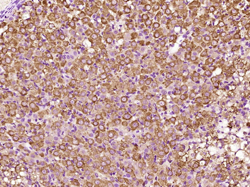 Paraformaldehyde-fixed, paraffin embedded Rat ovarian; Antigen retrieval by boiling in sodium citrate buffer (pH6.0) for 15min; Block endogenous peroxidase by 3% hydrogen peroxide for 20 minutes; Blocking buffer (normal goat serum) at 37°C for 30min; Antibody incubation with Kinectin 1 Polyclonal Antibody, Unconjugated (bs-17064R) at 1:400 overnight at 4°C, DAB staining.