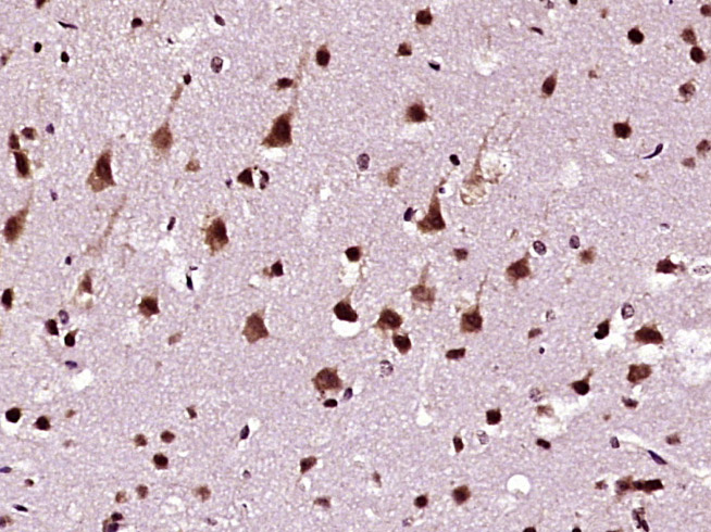Paraformaldehyde-fixed, paraffin embedded Mouse brain; Antigen retrieval by boiling in sodium citrate buffer (pH6.0) for 15min; Block endogenous peroxidase by 3% hydrogen peroxide for 20 minutes; Blocking buffer (normal goat serum) at 37°C for 30min; Antibody incubation with hnRNP DL Polyclonal Antibody, Unconjugated (bs-17343R) at 1:400 overnight at 4°C, DAB staining.