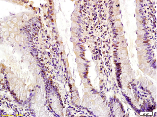 Formalin-fixed and paraffin embedded rat small intestine labeled with Anti-Egr1 Polyclonal Antibody, Unconjugated (bs-1076R) at 1:200 followed by conjugation to the secondary antibody and DAB staining.