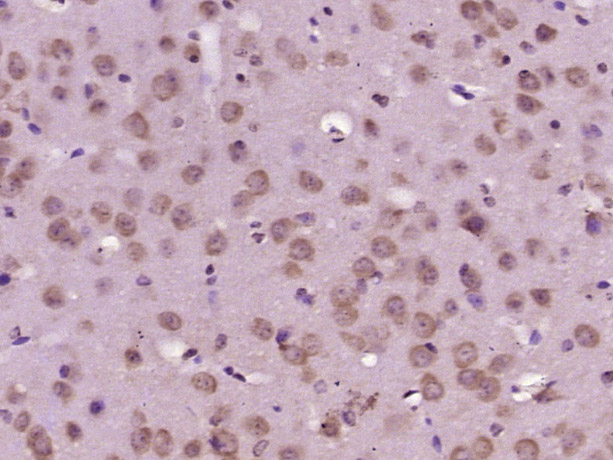 Paraformaldehyde-fixed, paraffin embedded Mouse brain; Antigen retrieval by boiling in sodium citrate buffer (pH6.0) for 15min; Block endogenous peroxidase by 3% hydrogen peroxide for 20 minutes; Blocking buffer (normal goat serum) at 37°C for 30min; Antibody incubation with HPS5 Polyclonal Antibody, Unconjugated (bs-17383R) at 1:400 overnight at 4°C, DAB staining.