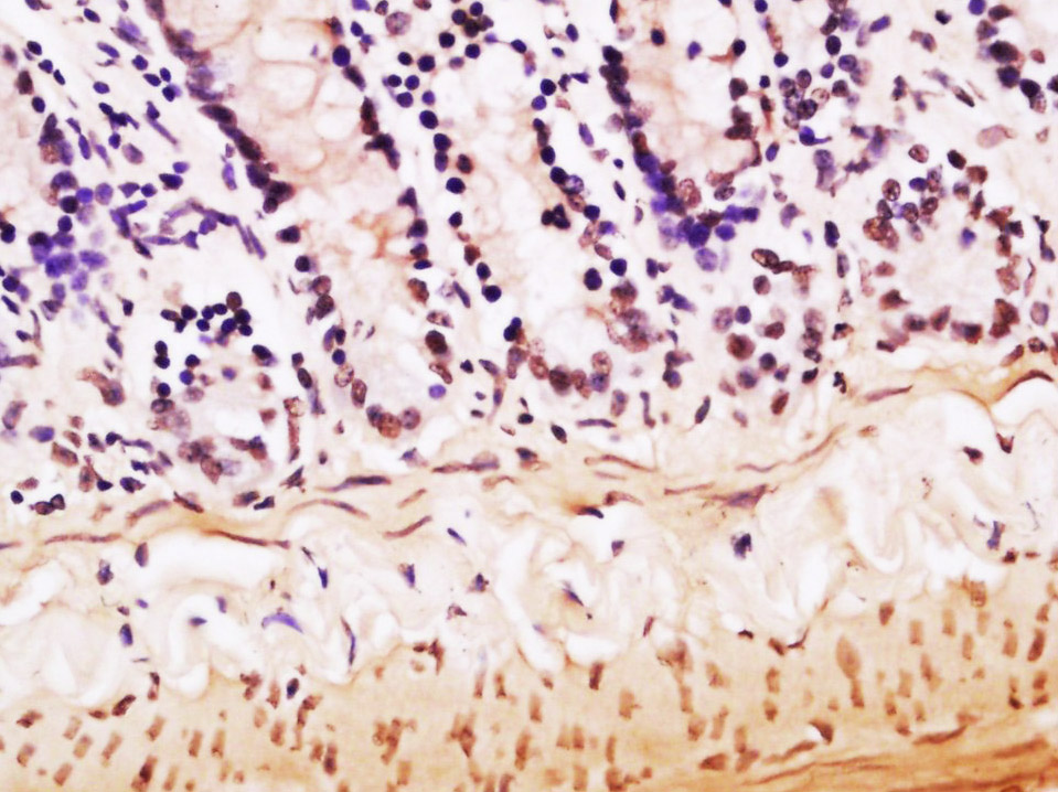 Paraformaldehyde-fixed, paraffin embedded Mouse intestine; Antigen retrieval by boiling in sodium citrate buffer (pH6.0) for 15min; Block endogenous peroxidase by 3% hydrogen peroxide for 20 minutes; Blocking buffer (normal goat serum) at 37°C for 30min; Antibody incubation with hnRNP M Polyclonal Antibody, Unconjugated (bs-10148R) at 1:200 overnight at 4°C, DAB staining.