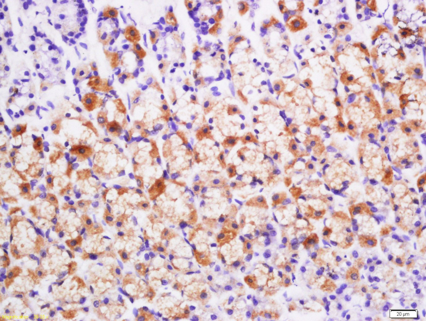 Paraformaldehyde-fixed, paraffin embedded Rat stomach; Antigen retrieval by boiling in sodium citrate buffer (pH6.0) for 15min; Block endogenous peroxidase by 3% hydrogen peroxide for 20 minutes; Blocking buffer (normal goat serum) at 37°C for 30min; Antibody incubation with BMP2 Polyclonal Antibody, Unconjugated (bs-10696R) at 1:200 overnight at 4°C, DAB staining.