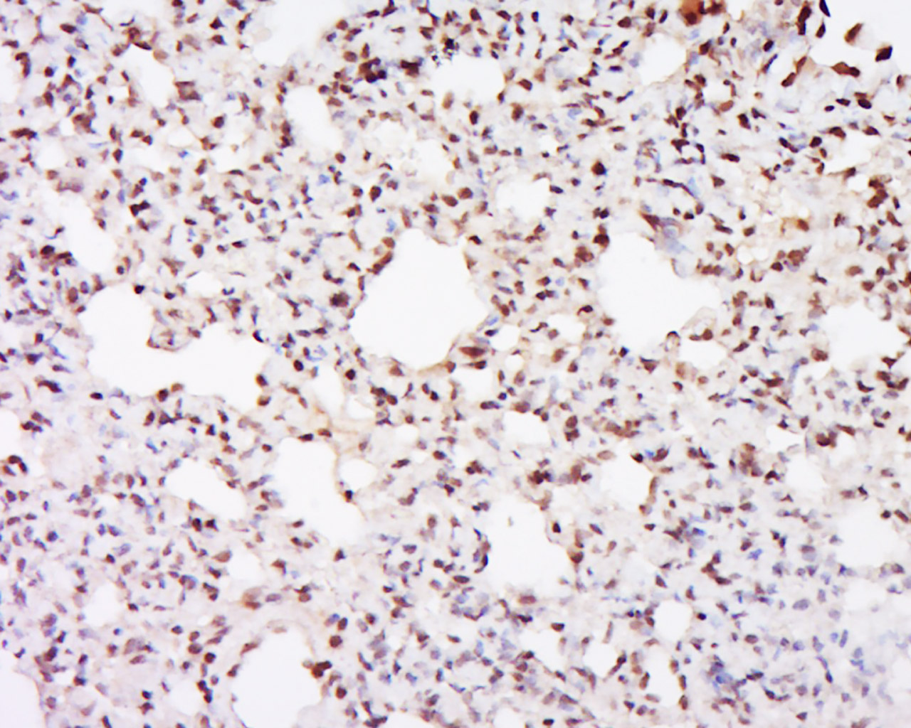 Paraformaldehyde-fixed, paraffin embedded Rat lung; Antigen retrieval by boiling in sodium citrate buffer (pH6.0) for 15min; Block endogenous peroxidase by 3% hydrogen peroxide for 20 minutes; Blocking buffer (normal goat serum) at 37°C for 30min; Antibody incubation with PTEN Polyclonal Antibody, Unconjugated (bs-0686R) at 1:500 overnight at 4°C, DAB staining.
