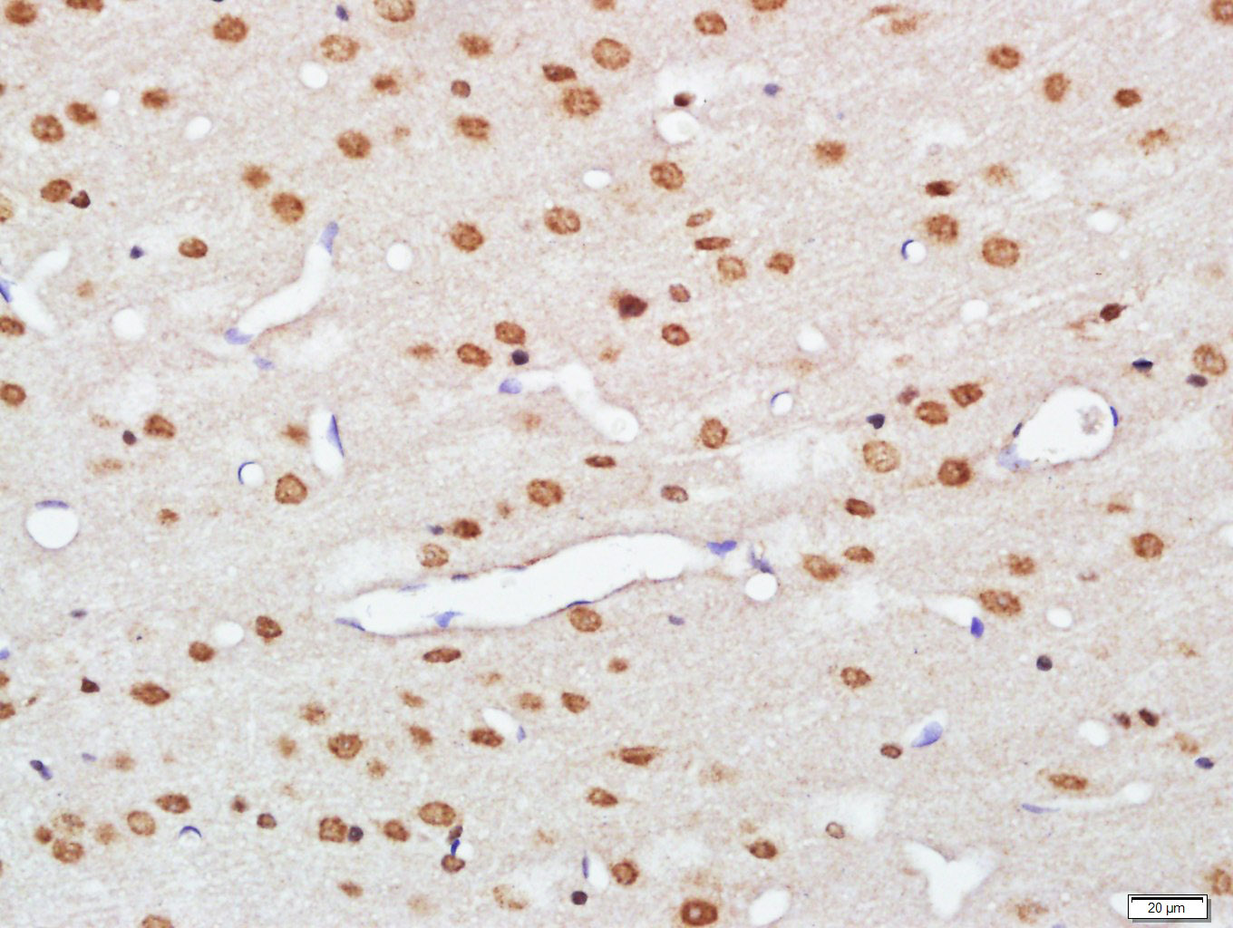 Paraformaldehyde-fixed, paraffin embedded Rat brain; Antigen retrieval by boiling in sodium citrate buffer (pH6.0) for 15min; Block endogenous peroxidase by 3% hydrogen peroxide for 20 minutes; Blocking buffer (normal goat serum) at 37°C for 30min; Antibody incubation with hnRNP M Polyclonal Antibody, Unconjugated (bs-10148R) at 1:500 overnight at 4°C, DAB staining.