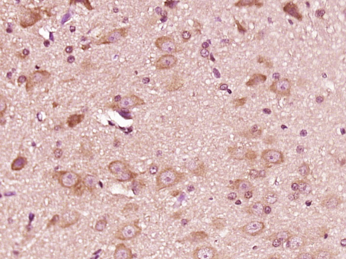 Paraformaldehyde-fixed, paraffin embedded Rat brain; Antigen retrieval by boiling in sodium citrate buffer (pH6.0) for 15min; Block endogenous peroxidase by 3% hydrogen peroxide for 20 minutes; Blocking buffer (normal goat serum) at 37°C for 30min; Antibody incubation with ATP6V1G2 Polyclonal Antibody, Unconjugated (bs-10930R) at 1:500 overnight at 4°C, DAB staining.