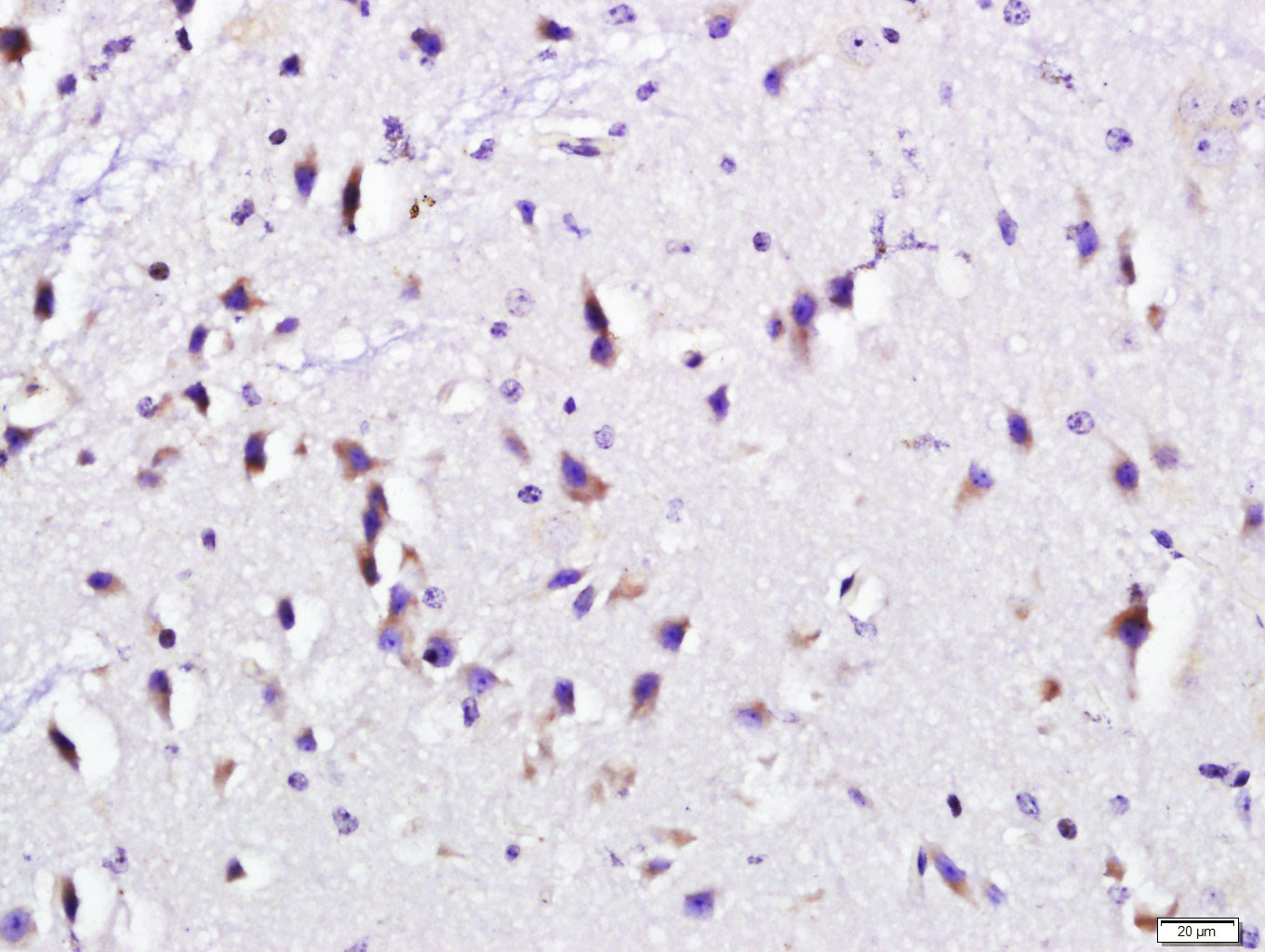 Paraformaldehyde-fixed, paraffin embedded Mouse brain; Antigen retrieval by boiling in sodium citrate buffer (pH6.0) for 15min; Block endogenous peroxidase by 3% hydrogen peroxide for 20 minutes; Blocking buffer (normal goat serum) at 37°C for 30min; Antibody incubation with RCAS1/EBAG9 Polyclonal Antibody, Unconjugated (bs-10982R) at 1:500 overnight at 4°C, DAB staining.