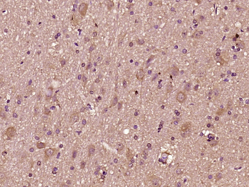 Paraformaldehyde-fixed, paraffin embedded Rat brain; Antigen retrieval by boiling in sodium citrate buffer (pH6.0) for 15min; Block endogenous peroxidase by 3% hydrogen peroxide for 20 minutes; Blocking buffer (normal goat serum) at 37°C for 30min; Antibody incubation with CTTNBP2 Polyclonal Antibody, Unconjugated (bs-14107R) at 1:500 overnight at 4°C, DAB staining.