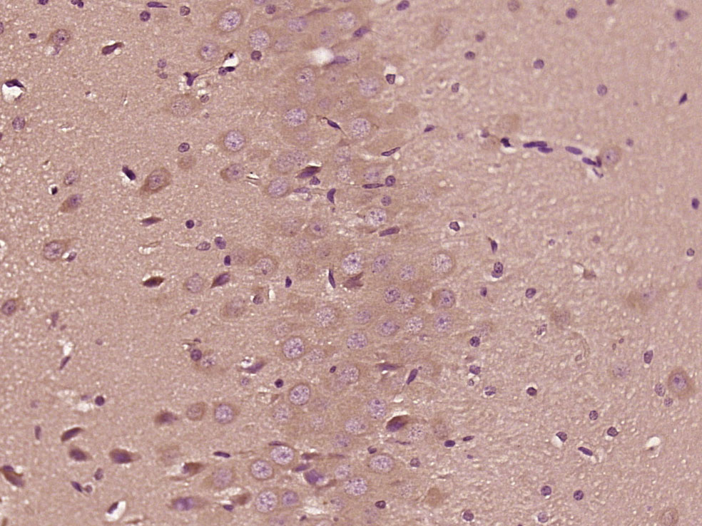 Paraformaldehyde-fixed, paraffin embedded Rat brain; Antigen retrieval by boiling in sodium citrate buffer (pH6.0) for 15min; Block endogenous peroxidase by 3% hydrogen peroxide for 20 minutes; Blocking buffer (normal goat serum) at 37°C for 30min; Antibody incubation with DENND1A Polyclonal Antibody, Unconjugated (bs-14269R) at 1:500 overnight at 4°C, DAB staining. Paraformaldehyde-fixed, paraffin embedded Rat brain; Antigen retrieval by boiling in sodium citrate buffer (pH6.0) for 15min; Block endogenous peroxidase by 3% hydrogen peroxide for 20 minutes; Blocking buffer (normal goat serum) at 37°C for 30min; Antibody incubation with DENND1A Polyclonal Antibody, Unconjugated (bs-14269R) at 1:500 overnight at 4°C, DAB staining.