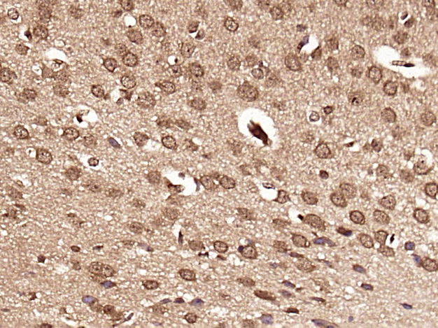 Paraformaldehyde-fixed, paraffin embedded Mouse brain; Antigen retrieval by boiling in sodium citrate buffer (pH6.0) for 15min; Block endogenous peroxidase by 3% hydrogen peroxide for 20 minutes; Blocking buffer (normal goat serum) at 37°C for 30min; Antibody incubation with DHX30 Polyclonal Antibody, Unconjugated (bs-14313R) at 1:500 overnight at 4°C, DAB staining.