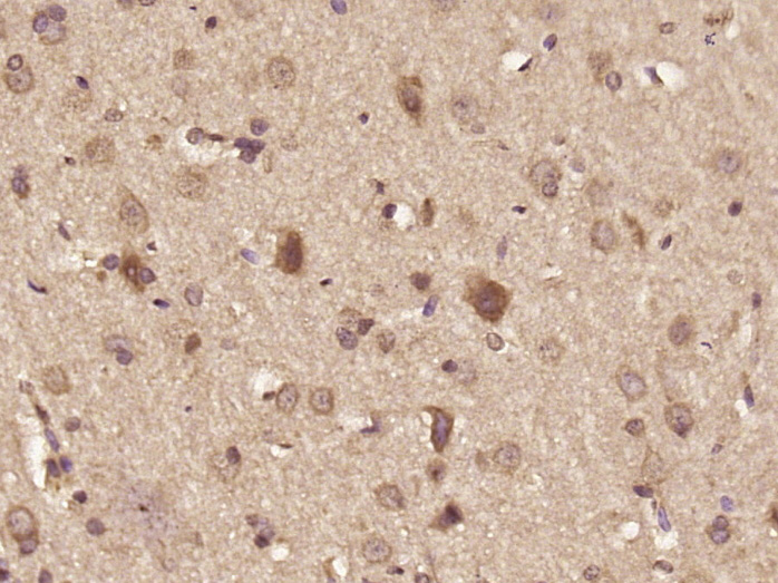 Paraformaldehyde-fixed, paraffin embedded Rat brain; Antigen retrieval by boiling in sodium citrate buffer (pH6.0) for 15min; Block endogenous peroxidase by 3% hydrogen peroxide for 20 minutes; Blocking buffer (normal goat serum) at 37°C for 30min; Antibody incubation with DHX36 Polyclonal Antibody, Unconjugated (bs-14319R) at 1:500 overnight at 4°C, DAB staining.