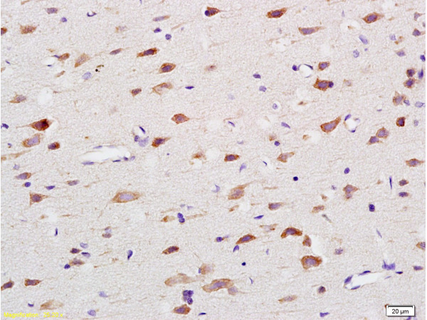 Formalin-fixed and paraffin embedded rat brain labeled with Anti-Nox4/NADH Polyclonal Antibody, Unconjugated (bs-1091R) at 1:200 followed by conjugation to the secondary antibody and DAB staining. Formalin-fixed and paraffin embedded rat brain labeled with Anti-Nox4/NADH Polyclonal Antibody, Unconjugated (bs-1091R) at 1:200 followed by conjugation to the secondary antibody and DAB staining.
