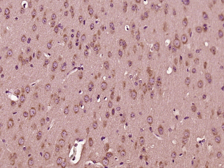 Paraformaldehyde-fixed, paraffin embedded Mouse brain; Antigen retrieval by boiling in sodium citrate buffer (pH6.0) for 15min; Block endogenous peroxidase by 3% hydrogen peroxide for 20 minutes; Blocking buffer (normal goat serum) at 37°C for 30min; Antibody incubation with DNAJC19 Polyclonal Antibody, Unconjugated (bs-14385R) at 1:500 overnight at 4°C, DAB staining.