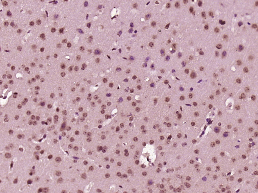 Paraformaldehyde-fixed, paraffin embedded Mouse brain; Antigen retrieval by boiling in sodium citrate buffer (pH6.0) for 15min; Block endogenous peroxidase by 3% hydrogen peroxide for 20 minutes; Blocking buffer (normal goat serum) at 37°C for 30min; Antibody incubation with EXOSC4 Polyclonal Antibody, Unconjugated (bs-14667R) at 1:500 overnight at 4°C, DAB staining.
