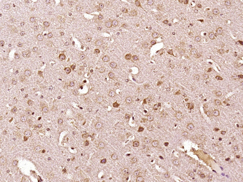 Paraformaldehyde-fixed, paraffin embedded Mouse brain; Antigen retrieval by boiling in sodium citrate buffer (pH6.0) for 15min; Block endogenous peroxidase by 3% hydrogen peroxide for 20 minutes; Blocking buffer (normal goat serum) at 37°C for 30min; Antibody incubation with PTEN Polyclonal Antibody, Unconjugated (bs-0686R) at 1:800 overnight at 4°C, DAB staining.