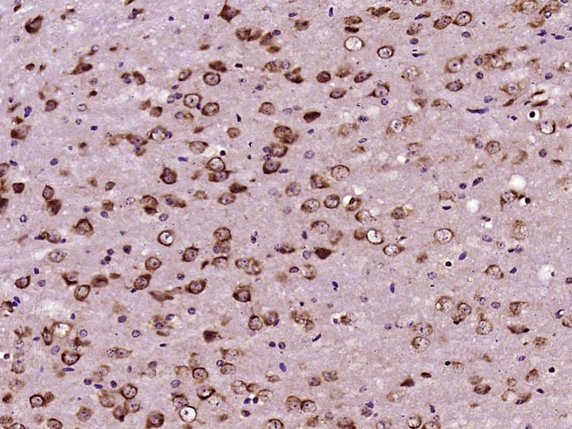 Paraformaldehyde-fixed, paraffin embedded Mouse brain; Antigen retrieval by boiling in sodium citrate buffer (pH6.0) for 15min; Block endogenous peroxidase by 3% hydrogen peroxide for 20 minutes; Blocking buffer (normal goat serum) at 37°C for 30min; Antibody incubation with CEP290 Polyclonal Antibody, Unconjugated (bs-13858R) at 1:800 overnight at 4°C, DAB staining.