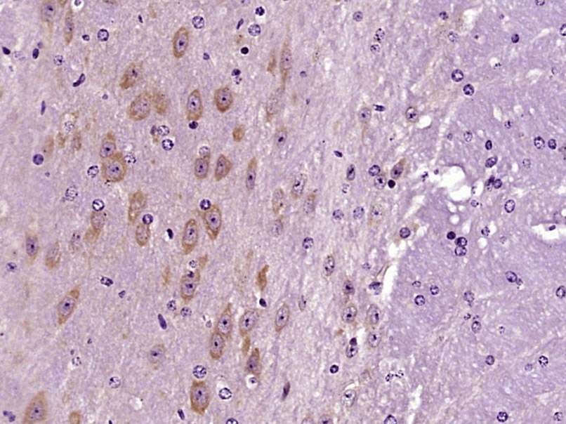 Paraformaldehyde-fixed, paraffin embedded Mouse brain; Antigen retrieval by boiling in sodium citrate buffer (pH6.0) for 15min; Block endogenous peroxidase by 3% hydrogen peroxide for 20 minutes; Blocking buffer (normal goat serum) at 37°C for 30min; Antibody incubation with OTUD6B Polyclonal Antibody, Unconjugated (bs-17567R) at 1:400 overnight at 4°C, DAB staining.