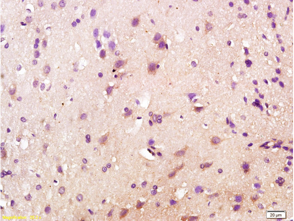 Formalin-fixed and paraffin embedded rat brain labeled with Anti-CD200R\/Orexin receptor Polyclonal Antibody, Unconjugated (bs-1095R) at 1:200 followed by conjugation to the secondary antibody and DAB staining.