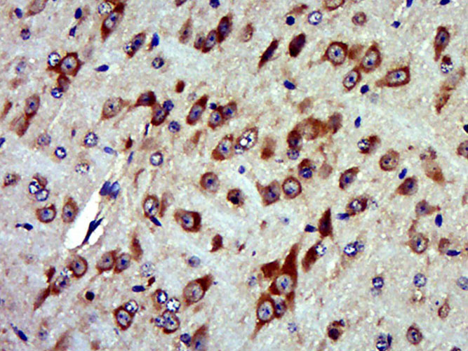Paraformaldehyde-fixed, paraffin embedded Mouse brain; Antigen retrieval by boiling in sodium citrate buffer (pH6.0) for 15min; Block endogenous peroxidase by 3% hydrogen peroxide for 20 minutes; Blocking buffer (normal goat serum) at 37°C for 30min; Antibody incubation with MTRF1 Polyclonal Antibody, Unconjugated (bs-17893R) at 1:400 overnight at 4°C, DAB staining.