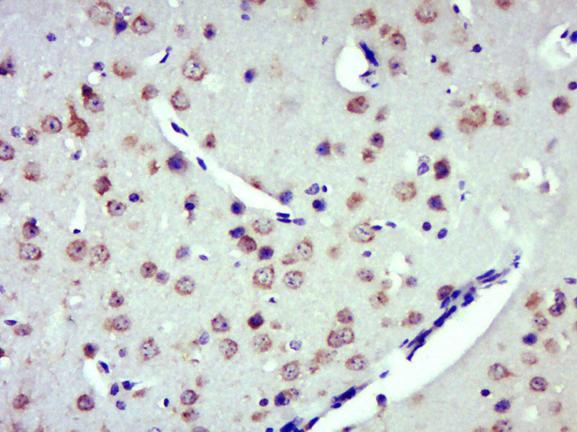 Paraformaldehyde-fixed, paraffin embedded Mouse brain; Antigen retrieval by boiling in sodium citrate buffer (pH6.0) for 15min; Block endogenous peroxidase by 3% hydrogen peroxide for 20 minutes; Blocking buffer (normal goat serum) at 37°C for 30min; Antibody incubation with ZDHHC8/ZNF378 Polyclonal Antibody, Unconjugated (bs-18486R) at 1:500 overnight at 4°C, DAB staining.