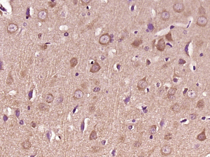 Paraformaldehyde-fixed, paraffin embedded Rat brain; Antigen retrieval by boiling in sodium citrate buffer (pH6.0) for 15min; Block endogenous peroxidase by 3% hydrogen peroxide for 20 minutes; Blocking buffer (normal goat serum) at 37°C for 30min; Antibody incubation with Liprin alpha 2 Polyclonal Antibody, Unconjugated (bs-18299R) at 1:400 overnight at 4°C, DAB staining.