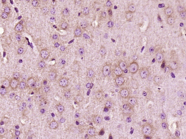 Paraformaldehyde-fixed, paraffin embedded Mouse brain; Antigen retrieval by boiling in sodium citrate buffer (pH6.0) for 15min; Block endogenous peroxidase by 3% hydrogen peroxide for 20 minutes; Blocking buffer (normal goat serum) at 37°C for 30min; Antibody incubation with LIPA2 Polyclonal Antibody, Unconjugated (bs-18299R) at 1:400 overnight at 4°C, DAB staining.