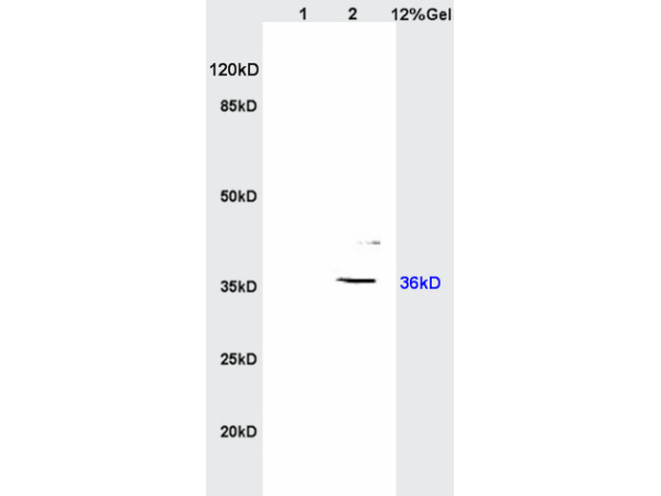 Lane 1: Rat Brain lysates; Lane 2: Human Colon Carcinoma lysates; Probed with IGFBP2 Polyclonal Antibody, Unconjugated (bs-1108R) at 1:200 overnight at 4˚C. Followed by secondary antibody (bs-0295G-HRP) incubation at 1:3000 for 90 min at 37˚C.