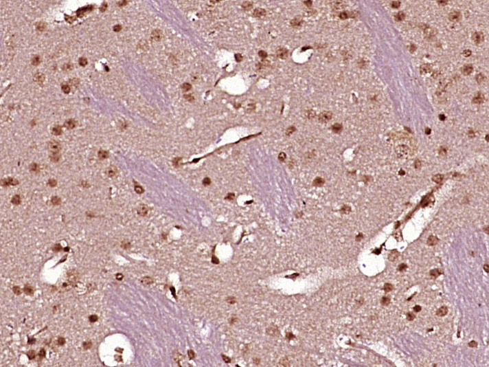 Paraformaldehyde-fixed, paraffin embedded Mouse brain; Antigen retrieval by boiling in sodium citrate buffer (pH6.0) for 15min; Block endogenous peroxidase by 3% hydrogen peroxide for 20 minutes; Blocking buffer (normal goat serum) at 37°C for 30min; Antibody incubation with ZC3H8 Polyclonal Antibody, Unconjugated (bs-18530R) at 1:400 overnight at 4°C, DAB staining.