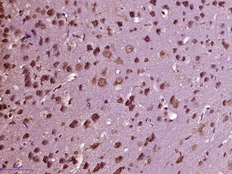 Paraformaldehyde-fixed, paraffin embedded Mouse brain; Antigen retrieval by boiling in sodium citrate buffer (pH6.0) for 15min; Block endogenous peroxidase by 3% hydrogen peroxide for 20 minutes; Blocking buffer (normal goat serum) at 37°C for 30min; Antibody incubation with MDM1 Polyclonal Antibody, Unconjugated (bs-18746R) at 1:400 overnight at 4°C, DAB staining.