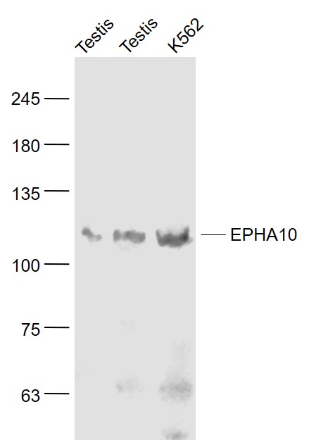 Lane 1: Mouse testis lysates;Lane 2: Rat testis lysates; Lane 3: K562 cell lysates probed with EPHA10 Polyclonal Antibody, Unconjugated (bs-10052R) at 1:1000 dilution and 4˚C overnight incubation. Followed by conjugated secondary antibody incubation at 1:20000 for 60 min at 37˚C.