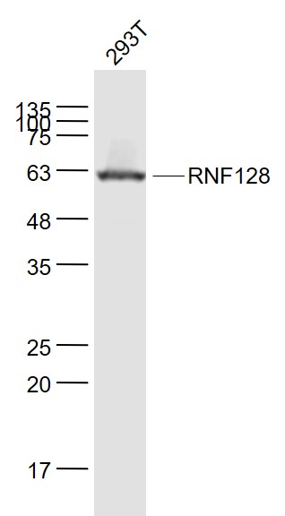 293T cell lysates probed with RNF128 Polyclonal Antibody, Unconjugated (bs-9251R) at 1:1000 dilution and 4˚C overnight incubation. Followed by conjugated secondary antibody incubation at 1:20000 for 60 min at 37˚C. 293T cell lysates probed with RNF128 Polyclonal Antibody, Unconjugated (bs-9251R) at 1:1000 dilution and 4˚C overnight incubation. Followed by conjugated secondary antibody incubation at 1:20000 for 60 min at 37˚C.