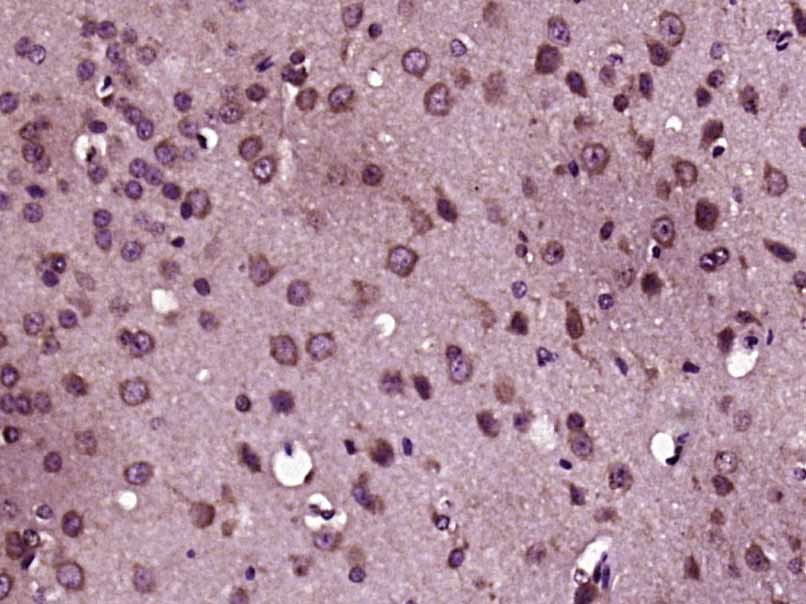 Paraformaldehyde-fixed, paraffin embedded Mouse brain; Antigen retrieval by boiling in sodium citrate buffer (pH6.0) for 15min; Block endogenous peroxidase by 3% hydrogen peroxide for 20 minutes; Blocking buffer (normal goat serum) at 37°C for 30min; Antibody incubation with MIA3 Polyclonal Antibody, Unconjugated (bs-18930R) at 1:400 overnight at 4°C, DAB staining.