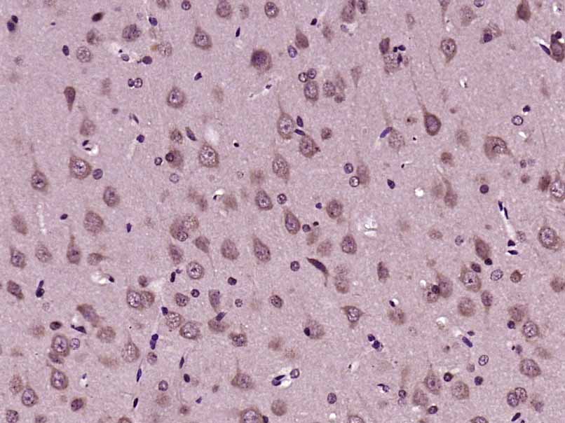 Paraformaldehyde-fixed, paraffin embedded Rat brain; Antigen retrieval by boiling in sodium citrate buffer (pH6.0) for 15min; Block endogenous peroxidase by 3% hydrogen peroxide for 20 minutes; Blocking buffer (normal goat serum) at 37°C for 30min; Antibody incubation with MIA3 Polyclonal Antibody, Unconjugated (bs-18930R) at 1:400 overnight at 4°C, DAB staining.