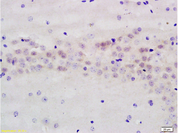 Formalin-fixed and paraffin embedded rat brain labeled with Anti-AMPK beta 1 Polyclonal Antibody, Unconjugated (bs-1116R) at 1:200 followed by conjugation to the secondary antibody and DAB staining.