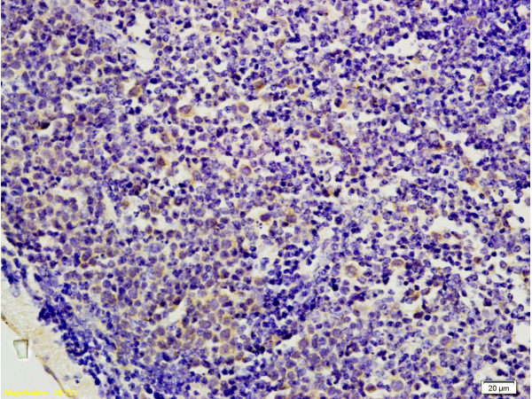 Formalin-fixed and paraffin embedded mouse colon carcinoma labeled with Anti-AMPK beta 1 Polyclonal Antibody, Unconjugated (bs-1116R) at 1:200 followed by conjugation to the secondary antibody and DAB staining.