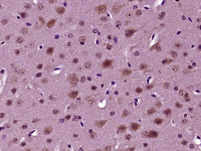 Paraformaldehyde-fixed, paraffin embedded Mouse brain; Antigen retrieval by boiling in sodium citrate buffer (pH6.0) for 15min; Block endogenous peroxidase by 3% hydrogen peroxide for 20 minutes; Blocking buffer (normal goat serum) at 37°C for 30min; Antibody incubation with NeuroD1 (Ser274) Polyclonal Antibody, Unconjugated (bs-19218R) at 1:400 overnight at 4°C, DAB staining.