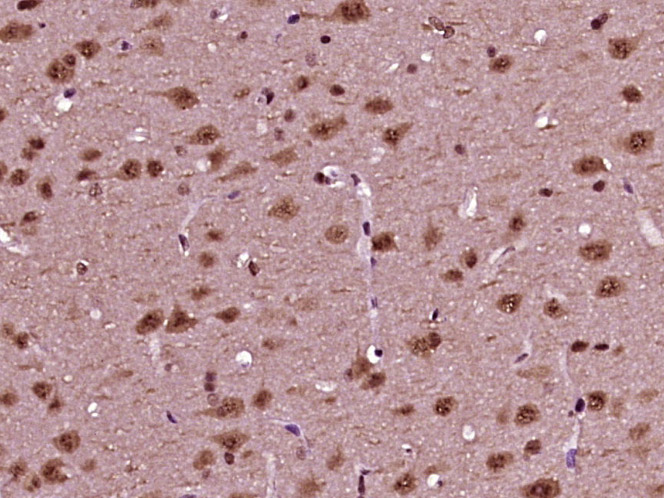 Paraformaldehyde-fixed, paraffin embedded Rat brain; Antigen retrieval by boiling in sodium citrate buffer (pH6.0) for 15min; Block endogenous peroxidase by 3% hydrogen peroxide for 20 minutes; Blocking buffer (normal goat serum) at 37°C for 30min; Antibody incubation with NeuroD1 (Ser274) Polyclonal Antibody, Unconjugated (bs-19218R) at 1:400 overnight at 4°C, DAB staining.