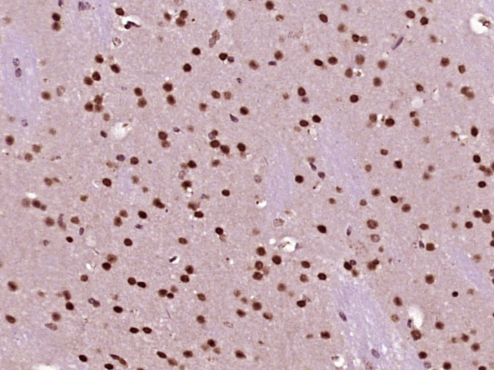 Paraformaldehyde-fixed, paraffin embedded Mouse brain; Antigen retrieval by boiling in sodium citrate buffer (pH6.0) for 15min; Block endogenous peroxidase by 3% hydrogen peroxide for 20 minutes; Blocking buffer (normal goat serum) at 37°C for 30min; Antibody incubation with NUP43 Polyclonal Antibody, Unconjugated (bs-19545R) at 1:400 overnight at 4°C, DAB staining.