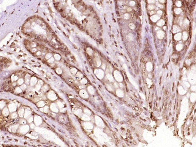 Paraformaldehyde-fixed, paraffin embedded Rat colon; Antigen retrieval by boiling in sodium citrate buffer (pH6.0) for 15min; Block endogenous peroxidase by 3% hydrogen peroxide for 20 minutes; Blocking buffer (normal goat serum) at 37°C for 30min; Antibody incubation with OASL/TRIP14 Polyclonal Antibody, Unconjugated (bs-19558R) at 1:400 overnight at 4°C, DAB staining.