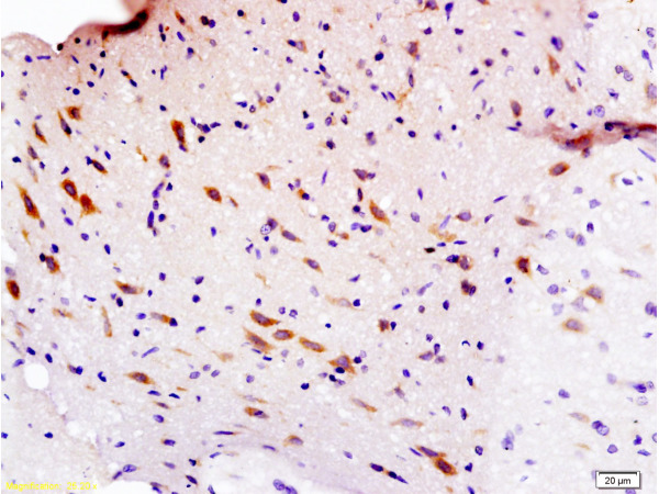 Formalin-fixed and paraffin embedded rat brain labeled with Anti-Sema3F/semaphorin 3F Polyclonal Antibody, Unconjugated (bs-1122R) at 1:200 followed by conjugation to the secondary antibody and DAB staining.
