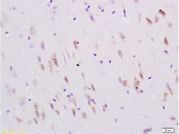 Formalin-fixed and paraffin embedded rat brain labeled with Anti-Sema4C/SEMA5A Polyclonal Antibody, Unconjugated (bs-2539R) at 1:200 followed by conjugation to the secondary antibody and DAB staining.