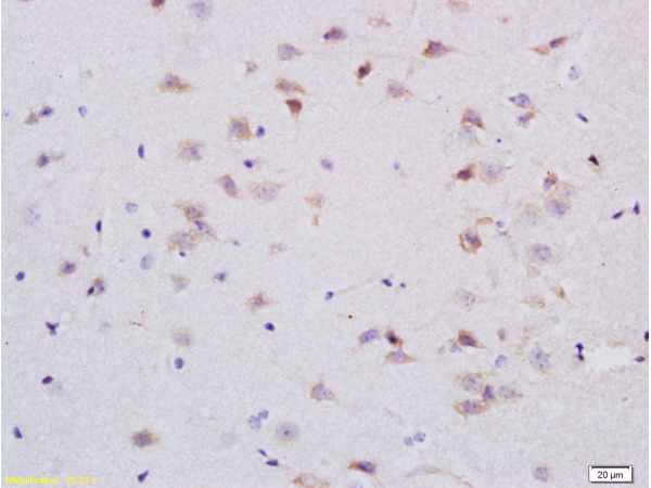 Formalin-fixed and paraffin embedded rat brain labeled with Anti-5-HTR1A\/HTR1A Polyclonal Antibody, Unconjugated (bs-1124R) at 1:200 followed by conjugation to the secondary antibody and DAB staining.