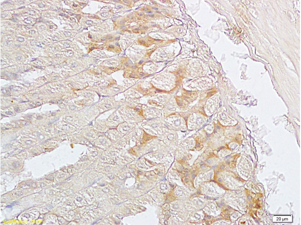 Formalin-fixed and paraffin embedded mouse stomach labeled with Anti-SGCB/SGC Polyclonal Antibody, Unconjugated (bs-1127R) at 1:200 followed by conjugation to the secondary antibody and DAB staining.