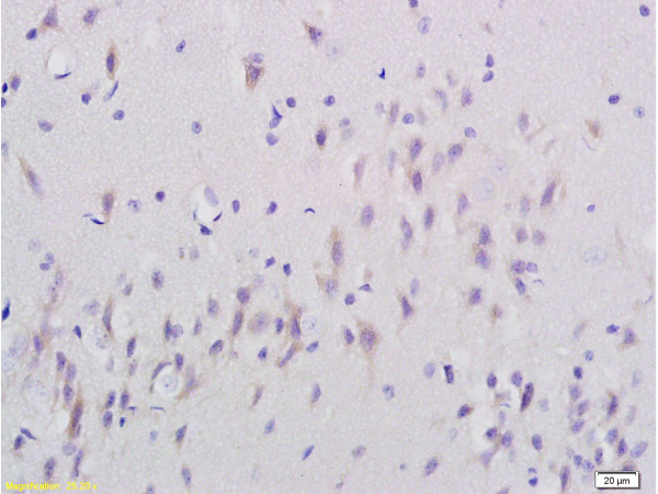 Formalin-fixed and paraffin embedded rat brain labeled with Anti-SNAP25 Polyclonal Antibody, Unconjugated (bs-1131R) at 1:200 followed by conjugation to the secondary antibody and DAB staining.