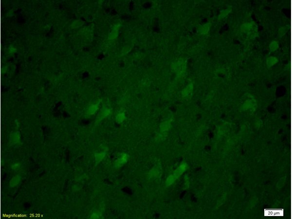 Formalin-fixed and paraffin-embedded rat brain labeled with Anti-SNAP25 Polyclonal Antibody, Unconjugated(bs-0022R) 1:200, overnight at 4°C, The secondary antibody was Goat Anti-Rabbit IgG, FiTC conjugated(bs-0295G-FITC)used at 1:200 dilution for 40 minutes at 37°C.