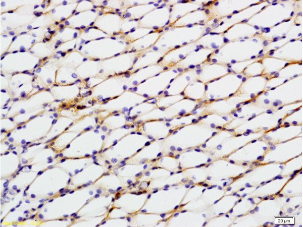 Formalin-fixed and paraffin embedded rat kidney tissue labeled with Anti-STAT2 Polyclonal Antibody, Unconjugated (bs-1140R) at 1:200 followed by conjugation to the secondary antibody, (SP-0023), and DAB staining