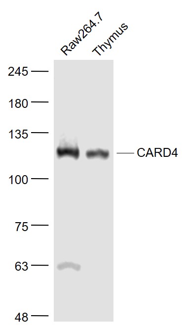 Lane 1: Raw264.7 cell lysates; Lane 2: Mouse thymus lysates probed with CARD4 Polyclonal Antibody, Unconjugated (bs-7085R) at 1:1000 dilution and 4˚C overnight incubation. Followed by conjugated secondary antibody incubation at 1:20000 for 60 min at 37˚C.