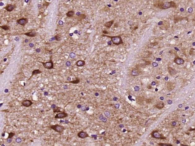 Paraformaldehyde-fixed, paraffin embedded Rat brain; Antigen retrieval by boiling in sodium citrate buffer (pH6.0) for 15min; Block endogenous peroxidase by 3% hydrogen peroxide for 20 minutes; Blocking buffer (normal goat serum) at 37°C for 30min; Antibody incubation with Dopamine D2 Receptor Polyclonal Antibody, Unconjugated (bs-20729R) at 1:400 overnight at 4°C, DAB staining. Paraformaldehyde-fixed, paraffin embedded Rat brain; Antigen retrieval by boiling in sodium citrate buffer (pH6.0) for 15min; Block endogenous peroxidase by 3% hydrogen peroxide for 20 minutes; Blocking buffer (normal goat serum) at 37°C for 30min; Antibody incubation with Dopamine D2 Receptor Polyclonal Antibody, Unconjugated (bs-20729R) at 1:400 overnight at 4°C, DAB staining.