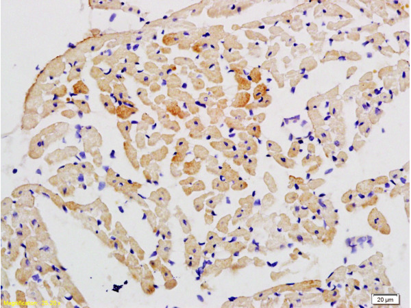 Formalin-fixed and paraffin embedded rat heart tissue labeled with Anti-STAT2 Polyclonal Antibody, Unconjugated (bs-1140R) at 1:200 followed by conjugation to the secondary antibody and DAB staining